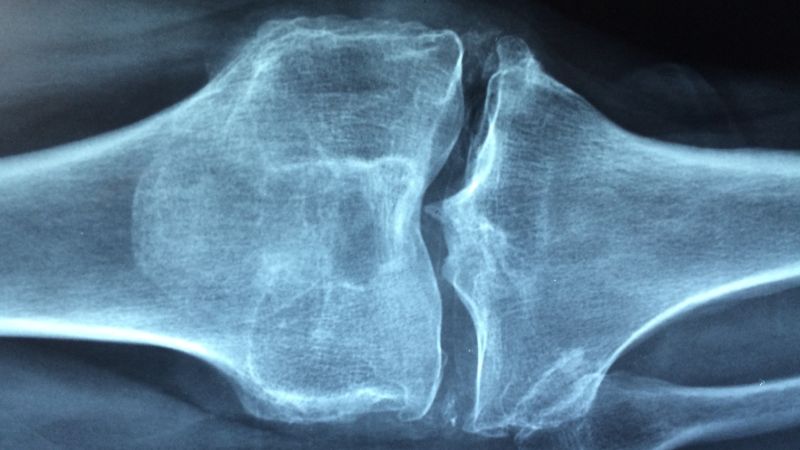 Autentificare - Radioterapie în tratamentul artrozei