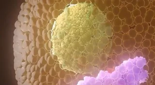 Pana unde intervenim asupra parametrilor lipidici?